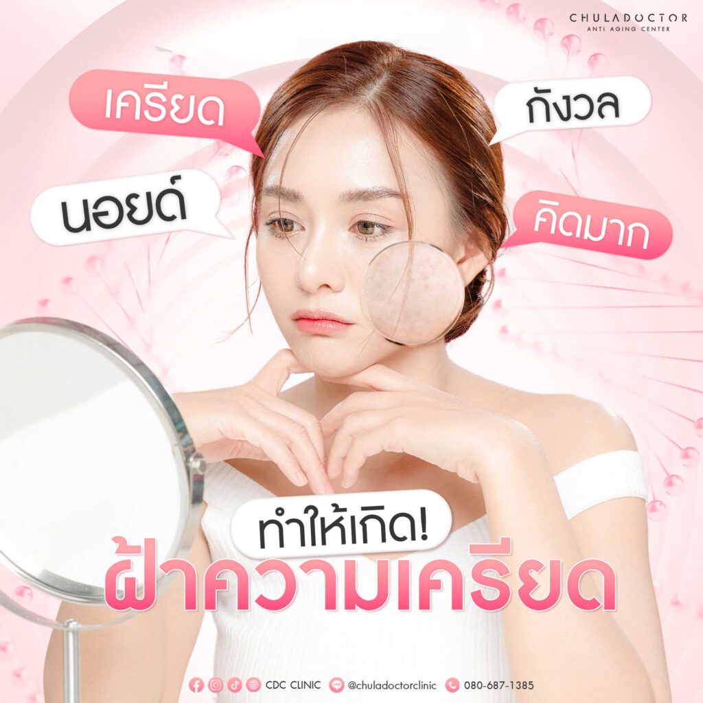 “นอยด์ เครียด กังวล คิดมาก” ทำให้เกิด ฝ้าความเครียด ได้ – Chula Doctor ...